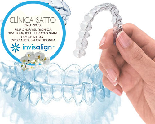 Ortodontia Invisalign