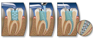 Endodontia